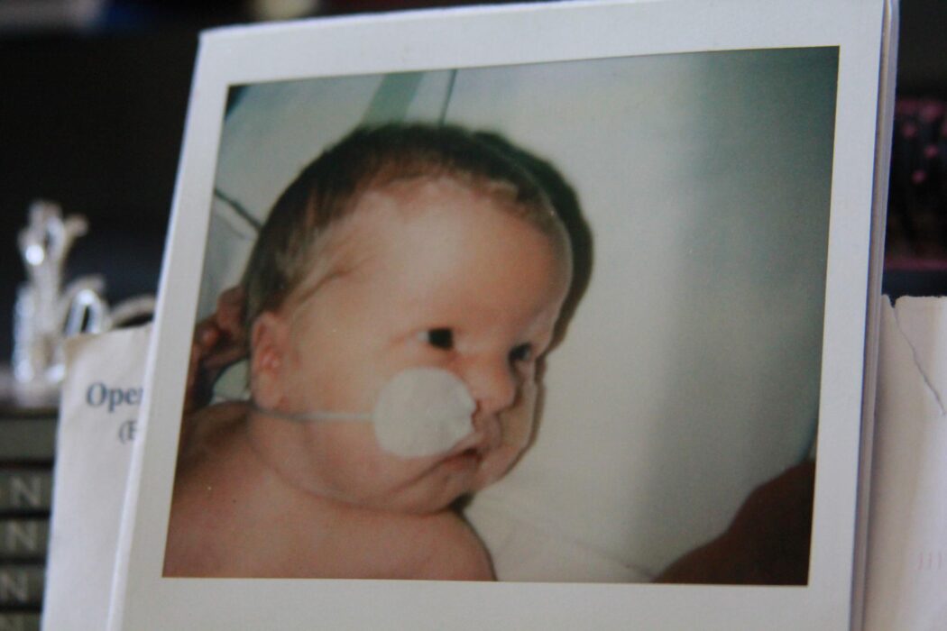 My S.C.B.U story | Neonatal Mental Health Awareness Week