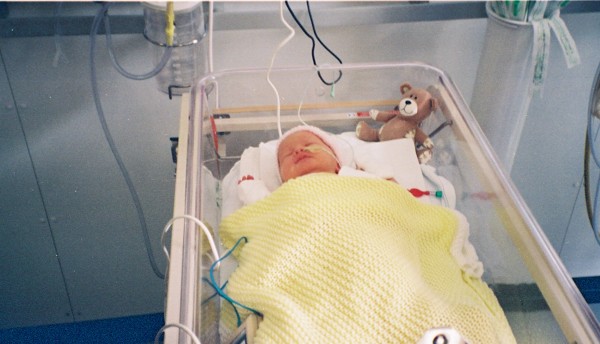 Premature baby girl