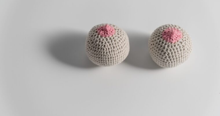 What to expect with a sebaceous cyst removal from the breast
