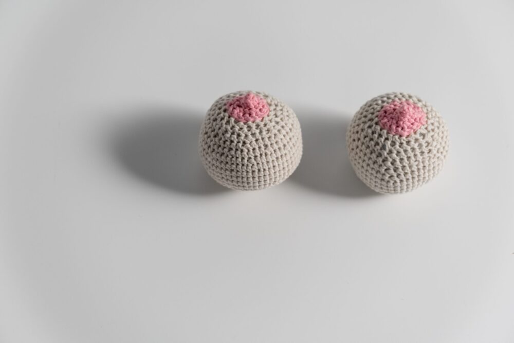 What to expect with a sebaceous cyst removal from the breast